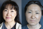Before ~ After 生徒作品