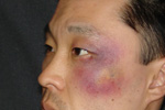 特殊メイクアップ（Injury）生徒作品
